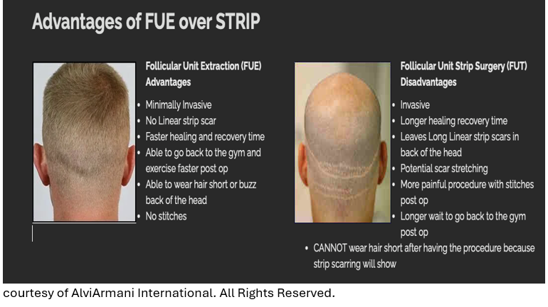 benefits of FUE hair therapy over FUT