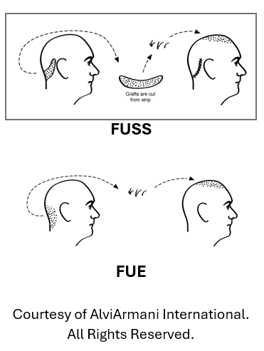 FUE vs FUSS hair therapy procedure