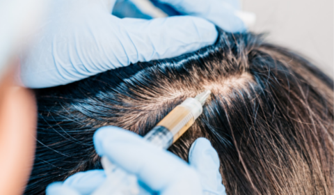 Platelet Rich Plasma (PRP): How to Naturally Enhance a Woman’s Hair Thickness and Hair Health