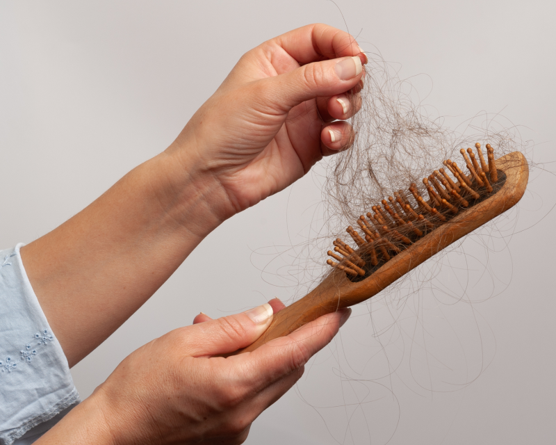 A woman’s hand pulling out strands of hair from her hairbrush which is a sign of hair loss in women