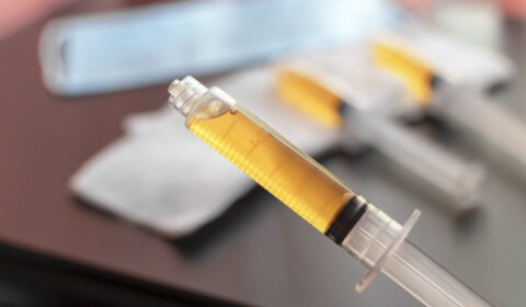 Faster Recovery With Maximized Growth: PRP and Women’s Hair Transplants