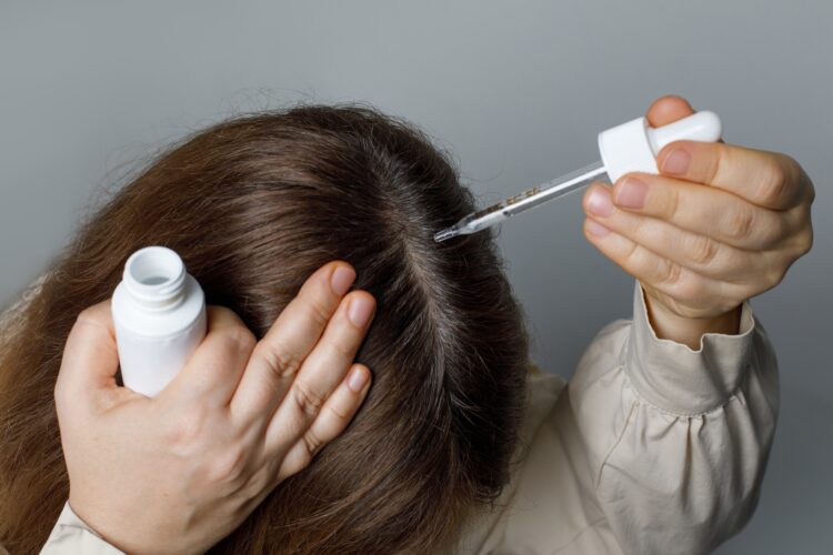 Minoxidil for Women's Hair Loss