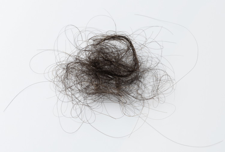 a chunk of fallen hair on the floor because of Telogen effluvium