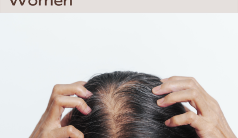 Understanding Telogen Effluvium in Women