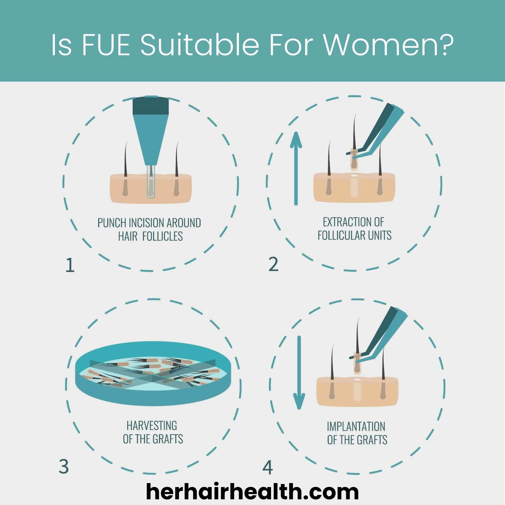 Is FUE Suitable for Women?